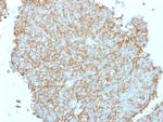 CD99/MIC2 (Ewing's Sarcoma Marker) Antibody in Immunohistochemistry (Paraffin) (IHC (P))