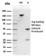 MIF (Macrophage Migration Inhibitory Factor) Antibody in SDS-PAGE (SDS-PAGE)