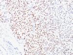 Microphthalmia Transcription Factor (MITF) Antibody in Immunohistochemistry (Paraffin) (IHC (P))