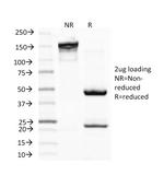 Microphthalmia Transcription Factor (MITF) Antibody in SDS-PAGE (SDS-PAGE)