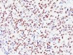 Microphthalmia Transcription Factor (MITF) Antibody in Immunohistochemistry (Paraffin) (IHC (P))