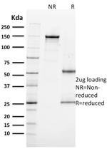 Microphthalmia Transcription Factor (MITF) Antibody in SDS-PAGE (SDS-PAGE)