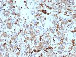 Microphthalmia Transcription Factor (MITF) Antibody in Immunohistochemistry (Paraffin) (IHC (P))