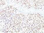 Microphthalmia Transcription Factor (MITF) Antibody in Immunohistochemistry (Paraffin) (IHC (P))