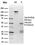 Microphthalmia Transcription Factor (MITF) Antibody in SDS-PAGE (SDS-PAGE)