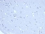 Ki-67 Antibody in Immunohistochemistry (Paraffin) (IHC (P))