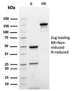 Ki-67 Antibody in SDS-PAGE (SDS-PAGE)