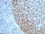 Ki-67 Antibody in Immunohistochemistry (Paraffin) (IHC (P))