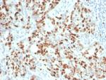 Ki-67 Antibody in Immunohistochemistry (Paraffin) (IHC (P))