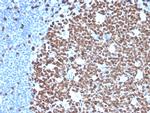 Ki-67 Antibody in Immunohistochemistry (Paraffin) (IHC (P))