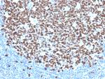 Ki-67 Antibody in Immunohistochemistry (Paraffin) (IHC (P))