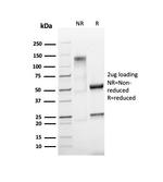 Ki-67 Antibody in SDS-PAGE (SDS-PAGE)