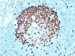 Ki-67 Antibody in Immunohistochemistry (Paraffin) (IHC (P))