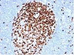 Ki-67 Antibody in Immunohistochemistry (Paraffin) (IHC (P))