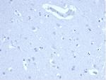 Ki-67 Antibody in Immunohistochemistry (Paraffin) (IHC (P))