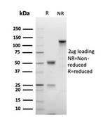 Ki-67 Antibody in SDS-PAGE (SDS-PAGE)