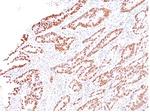 MLH1 (MutL Homolog 1) Antibody in Immunohistochemistry (Paraffin) (IHC (P))