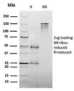 MLH1 (MutL Homolog 1)/HNPCC Antibody in SDS-PAGE (SDS-PAGE)