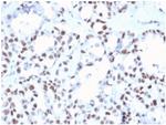 MLH1 (MutL Homolog 1)/HNPCC Antibody in Immunohistochemistry (Paraffin) (IHC (P))