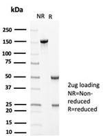 MLH1 (MutL Homolog 1) (Center)/HNPCC Antibody in SDS-PAGE (SDS-PAGE)