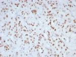 MLH1 (MutL Homolog 1)/HNPCC Antibody in Immunohistochemistry (Paraffin) (IHC (P))