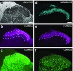 CaMKII alpha Antibody in Immunohistochemistry (IHC)