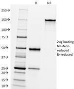 CD10 (Membrane Metalloendopeptidase) Antibody in SDS-PAGE (SDS-PAGE)