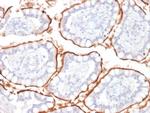 CD10 (Membrane Metalloendopeptidase) Antibody in Immunohistochemistry (Paraffin) (IHC (P))