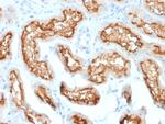 CD10 (Membrane Metalloendopeptidase) Antibody in Immunohistochemistry (Paraffin) (IHC (P))