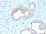 CD10 (Membrane Metalloendopeptidase) Antibody in Immunohistochemistry (Paraffin) (IHC (P))