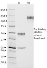 CD10 (Membrane Metalloendopeptidase) Antibody in SDS-PAGE (SDS-PAGE)