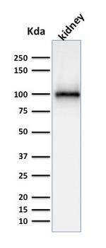 CD10 (Membrane Metalloendopeptidase) Antibody in Western Blot (WB)