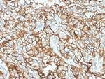 CD10 (Membrane Metalloendopeptidase) Antibody in Immunohistochemistry (Paraffin) (IHC (P))