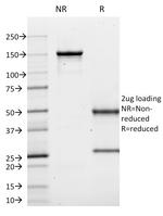 CD10 (Membrane Metalloendopeptidase) Antibody in SDS-PAGE (SDS-PAGE)