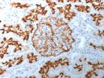 CD10 (Membrane Metalloendopeptidase) Antibody in Immunohistochemistry (Paraffin) (IHC (P))