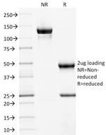 CD10 (Membrane Metalloendopeptidase) Antibody in SDS-PAGE (SDS-PAGE)