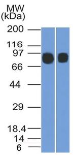 CD10 (Membrane Metalloendopeptidase) Antibody in Western Blot (WB)