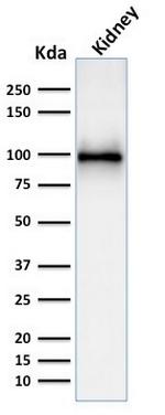 CD10 (Membrane Metalloendopeptidase) Antibody in Western Blot (WB)