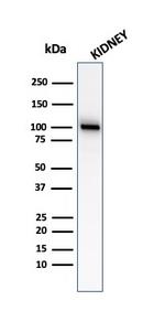 CD10 (Membrane Metalloendopeptidase) Antibody in Western Blot (WB)