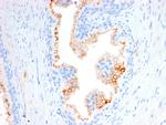 CD10 (Membrane Metalloendopeptidase) Antibody in Immunohistochemistry (Paraffin) (IHC (P))