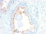 CD10 (Membrane Metalloendopeptidase) Antibody in Immunohistochemistry (Paraffin) (IHC (P))