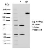 CD10 (Membrane Metalloendopeptidase) Antibody in SDS-PAGE (SDS-PAGE)