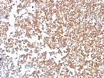 CD10 (Membrane Metalloendopeptidase) Antibody in Immunohistochemistry (Paraffin) (IHC (P))