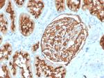 CD10 (Membrane Metalloendopeptidase) Antibody in Immunohistochemistry (Paraffin) (IHC (P))