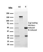 CD10 (Membrane Metalloendopeptidase) Antibody in SDS-PAGE (SDS-PAGE)