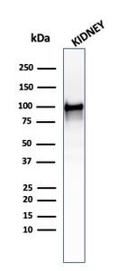 CD10 (Membrane Metalloendopeptidase) Antibody in Western Blot (WB)