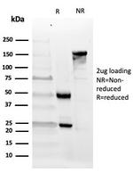 CD10 (Membrane Metalloendopeptidase) Antibody in SDS-PAGE (SDS-PAGE)