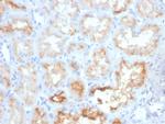 CD10 (Membrane Metalloendopeptidase) Antibody in Immunohistochemistry (Paraffin) (IHC (P))