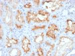 CD10 (Membrane Metalloendopeptidase) Antibody in Immunohistochemistry (Paraffin) (IHC (P))