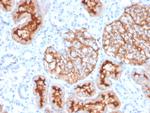 CD10 (Membrane Metalloendopeptidase) Antibody in Immunohistochemistry (Paraffin) (IHC (P))